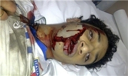 135 شهید و 10 هزار زخمی حاصل سرکوبگری رژیم بحرین