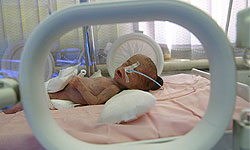وضعیت مطلوب جسمی نوزاد قزوینی 