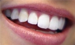 آموزش بهداشت دهان و دندان کودکان شهرستان جم
