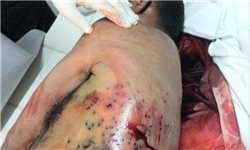 مستندسازی ۳۴۲۰ مورد آسیب‌دیدگی معترضان در بحرین/ ۲۴ درصد آسیب‌ها از ناحیه سر و گردن
