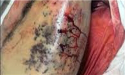 زخمی شدن ۲۵ تظاهرات‌کننده بحرینی/ اصابت گلوله به ریه، قلب و چشم معترضان