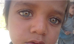 بیش از 3 هزار کودک مشکوک به تنبلی چشم هستند
