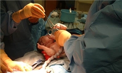 بسیاری از عمل‌های جراحی سودجویانه است / ایران دومین کشور در عمل سزارین