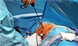 عمل جراحی لاپاراسکوپی در مشهد بی‌نظیر است