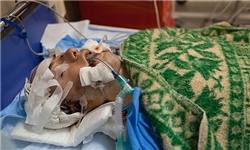 اهدای هفتمین عضو بدن بیمار مرگ مغزی در کهگیلویه و بویراحمد