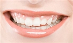 چیپس و پفک باعث پوسیدگی دندان در کودکان می‌شود