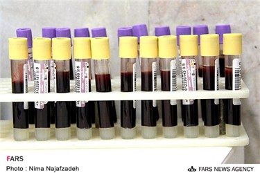 نمونه خون آزمایشگاهی