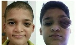 یک کودک بحرینی بر اثر استنشاق گازهای سمی آل‌خلیفه به شهادت رسید