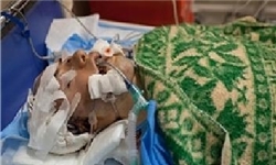 اهدای اعضای بدن کودک 5 ساله به 3 بیمار