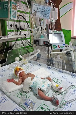 تولد نوزادان چهار قلو در زنجان
