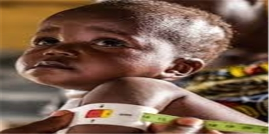 سوء تغذیه جان دو میلیون کودک در کنگو را تهدید می‌کند