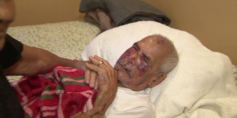 حمله نژادپرستانه با آجر به پیرمرد ۹۲ ساله در لس آنجلس + عکس