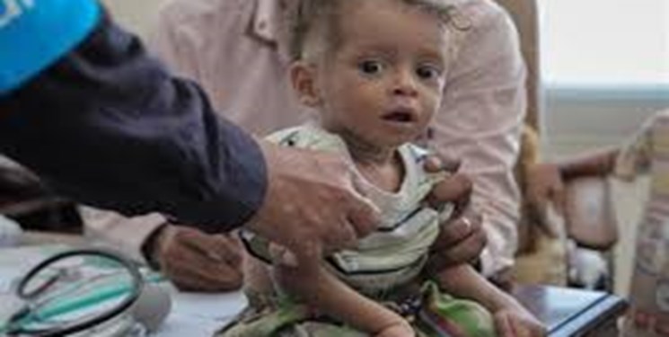 یونیسف از مرگ سالانه 66 هزار کودک یمنی بر اثر بیماری‌های ساده خبر داد