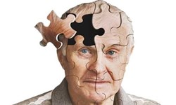 دانشمندان در مورد تاثیر آلزایمر بر آشفتگی روان تحقیق می کنند