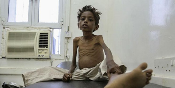 بیش از پنج میلیون کودک یمنی در معرض قحطی هستند