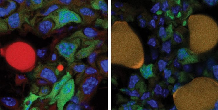 کشف روش جدید تبدیل سلول های سرطانی به سلول های چربی