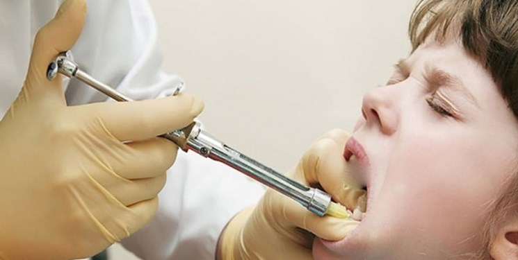 مصرف برخی «داروها» و «وراثت» عامل  شکل گیری نامناسب دندان کودکان می‌شود