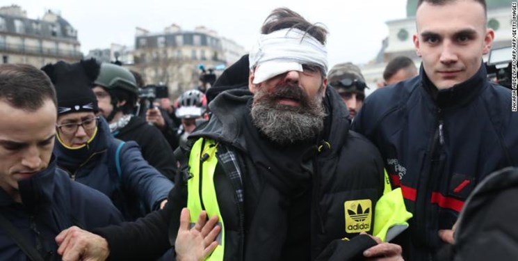 سی‌ان‌ان: دستکم ۲۴ معترض فرانسوی از ناحیه چشم آسیب دیده‌اند