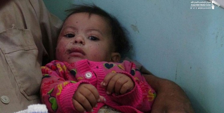 عکس| «حلیمه» نوزاد 9 ماهه؛ نماد جدید قربانیان عربستان سعودی در یمن