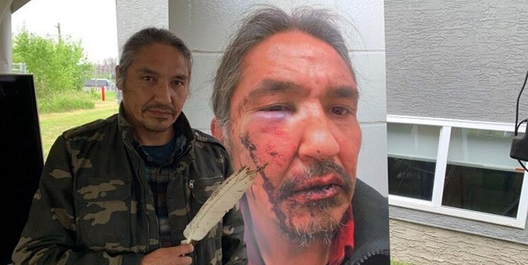 واکنش‌ها به حمله پلیس کانادا به یک رهبر بومی این کشور