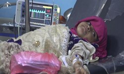 صنعاء: وضعیت انسانی یمن لکه ننگی بر پیشانی سازمان ملل است