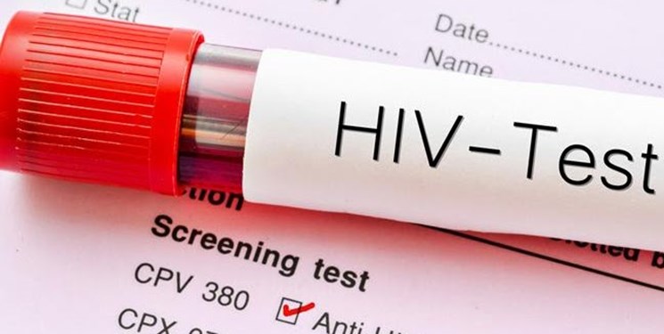 شناسایی  ۷۴۰ بیمار مبتلا به HIV  در همدان/مراقبت از 16 بیمار جدید