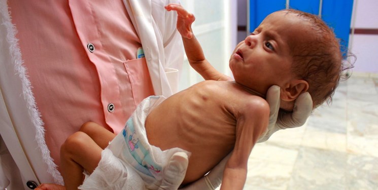 فائو: 5 میلیون یمنی یک گام با قحطی فاصله دارند