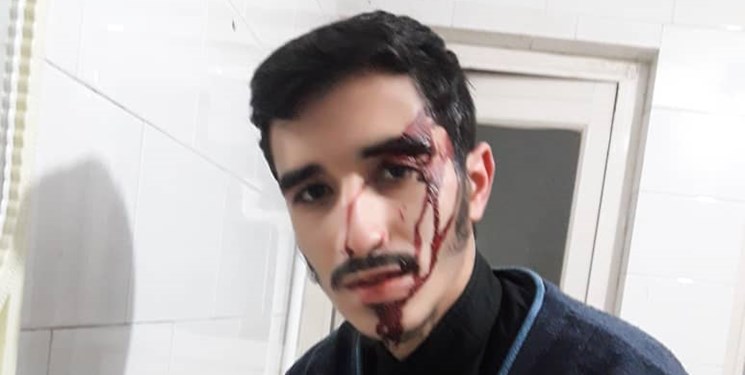 ضرب و شتم طلبه بسیجی در تهران | سلیمانی: ضارب بدون هیچ دلیلی به من حمله کرد