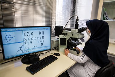 بررسی کروموزوم های یکی از بیماران زیر میکروسکوپ