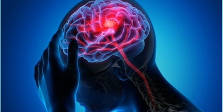 درمان اختلال گفتار در بیماران سکته مغزی به کمک توان‌بخشی شناختی