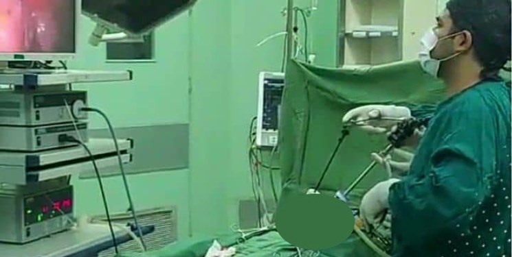 انجام جراحی «آپاندیسیت» به روش لاپاراسکوپیک برای اولین بار در اسفراین