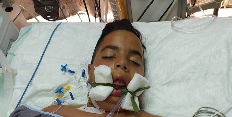 شهادت کودک فلسطینی بر اثر شدت جراحات وارده در جنین+عکس