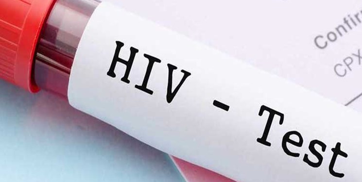 درصد شناسایی زنان، در بیماران مبتلا به ایدز در حال افزایش است