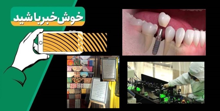 خبر خوب| ایمپلنتهای وطنی؛ دستاورد شرکت دانشبنیان