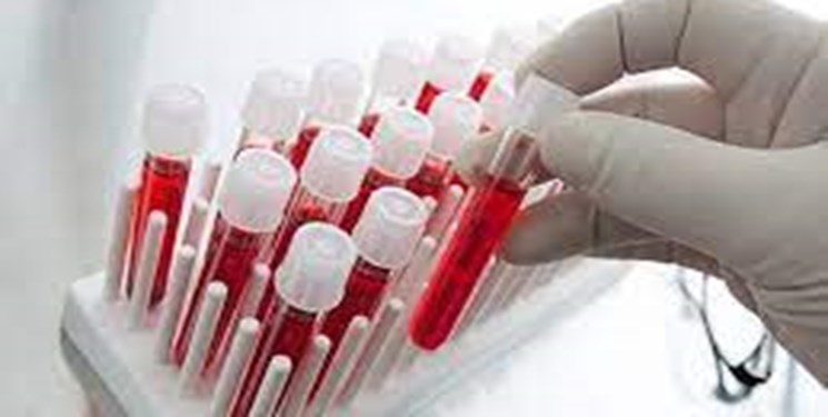 چگونگی فعالیت مراکز ملی تأمین سلولهای بنیادی در سازمان انتقال خون