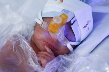 تولد پنچ قلوها