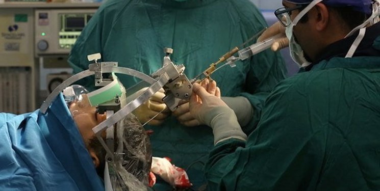 انجام پیچیده‌ترین جراحی تومور مغزی کشور برای اولین بار در یزد