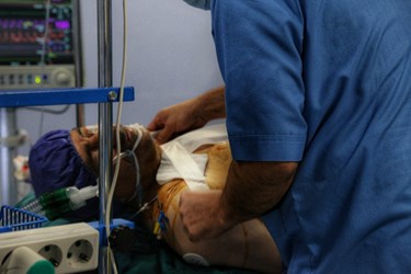 عمل قلب باز در البرز 
