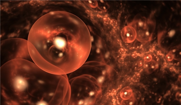 picture of kidney stones in humans picture of kidney stones in humans